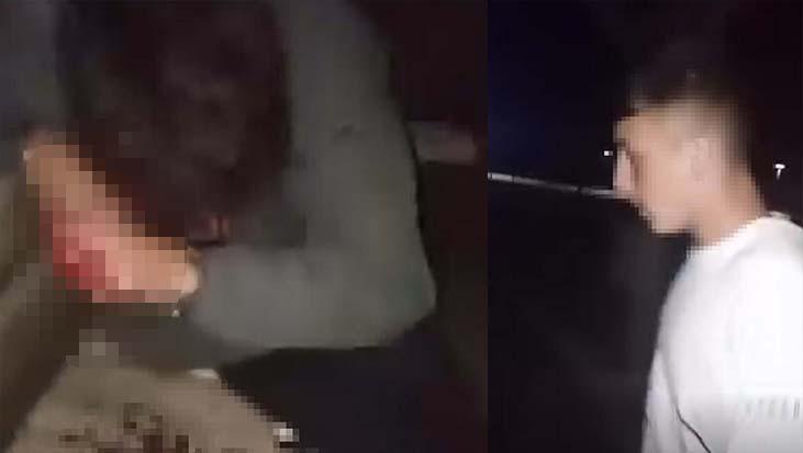 Lise öğrencileri arasında kanlı kavga! Arkadaşını parka çağırarak darbetti