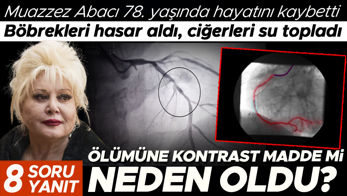 Böbrekleri hasar aldı, ciğerleri su topladı… Muazzez Abacı’nın ölümüne kontrastlı sıvı mı neden oldu? | 8 SORU 8 YANIT