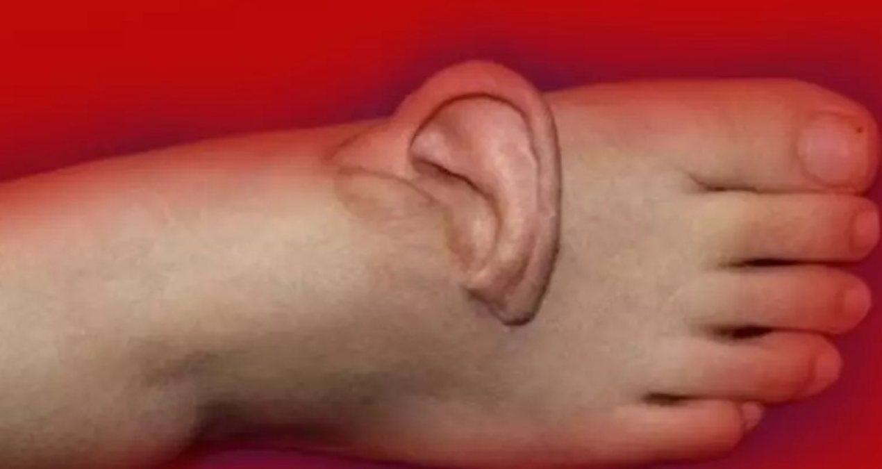 Kopan kulağını ayağına diktiler